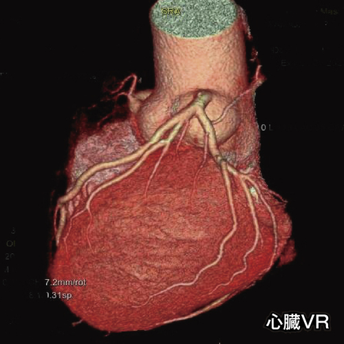 心臓VRの画像